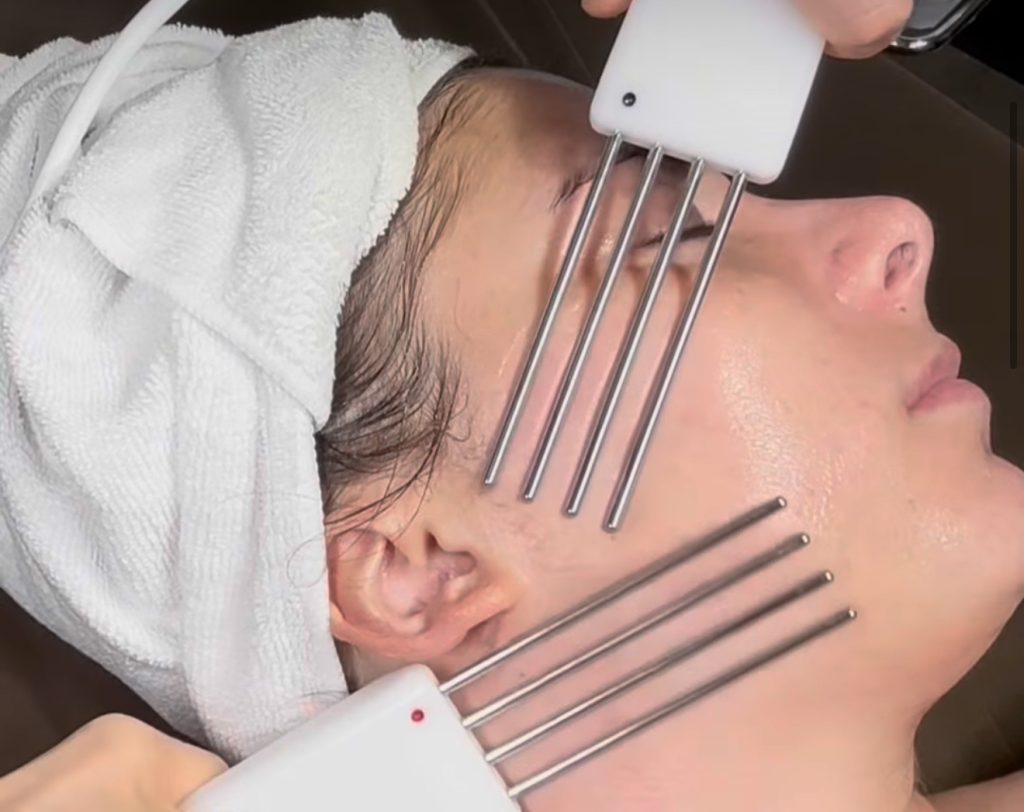 lifting sans chirurgie visage naturel